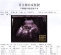 18w+2